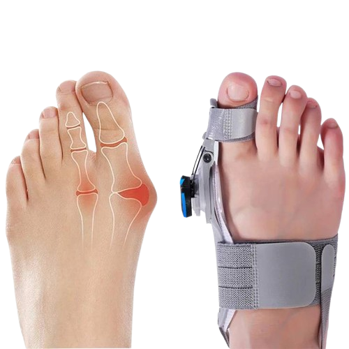 Natural Bunions Corrector Toe Spacer – Belro