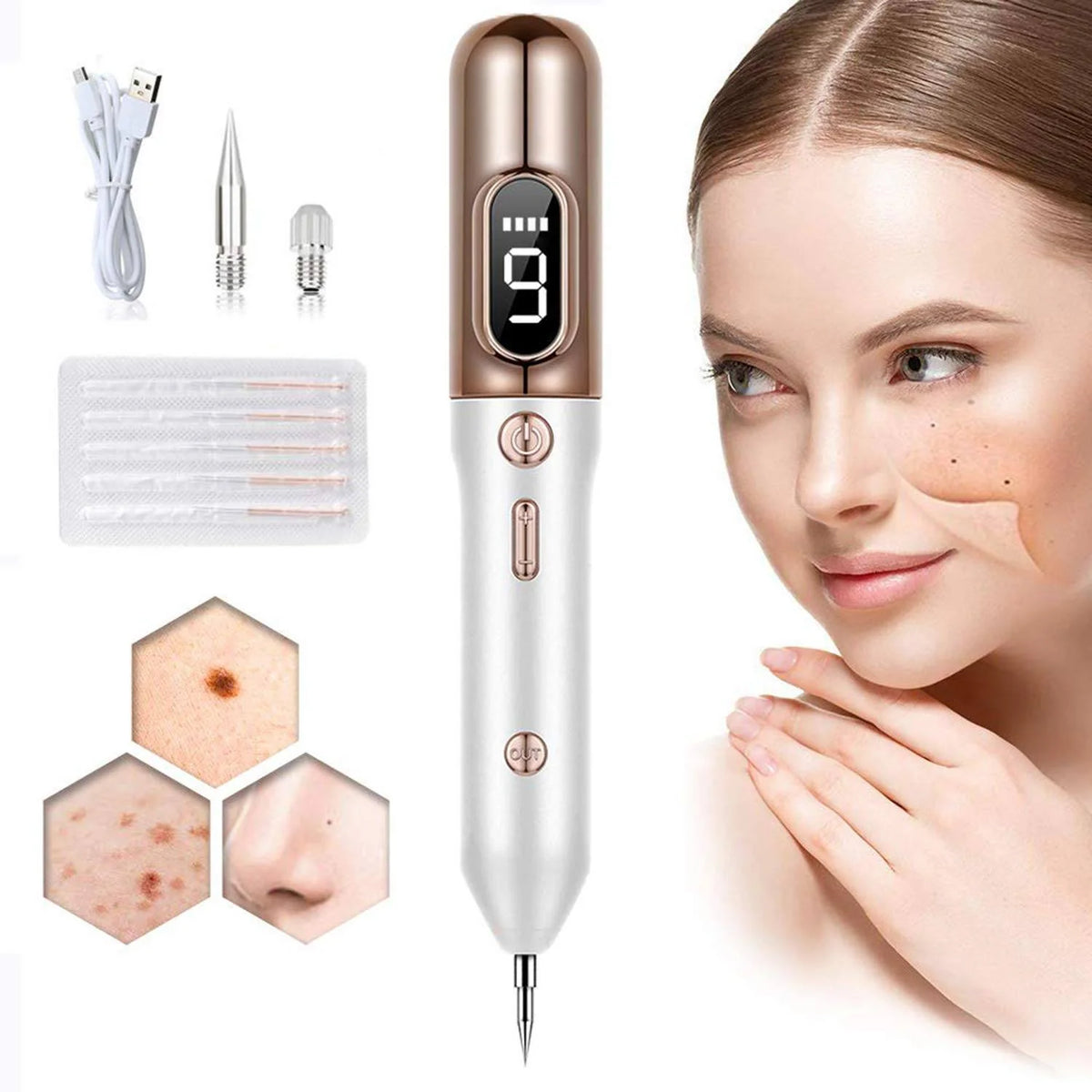 Plasma Pen To Remove Skin Tags, Moles And Warns – Belro